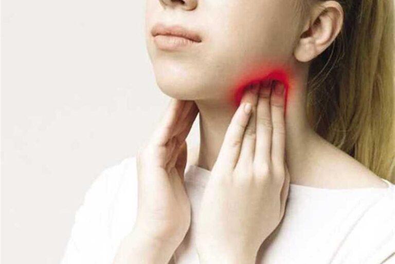 علاج التهابات الحلق بالأعشاب